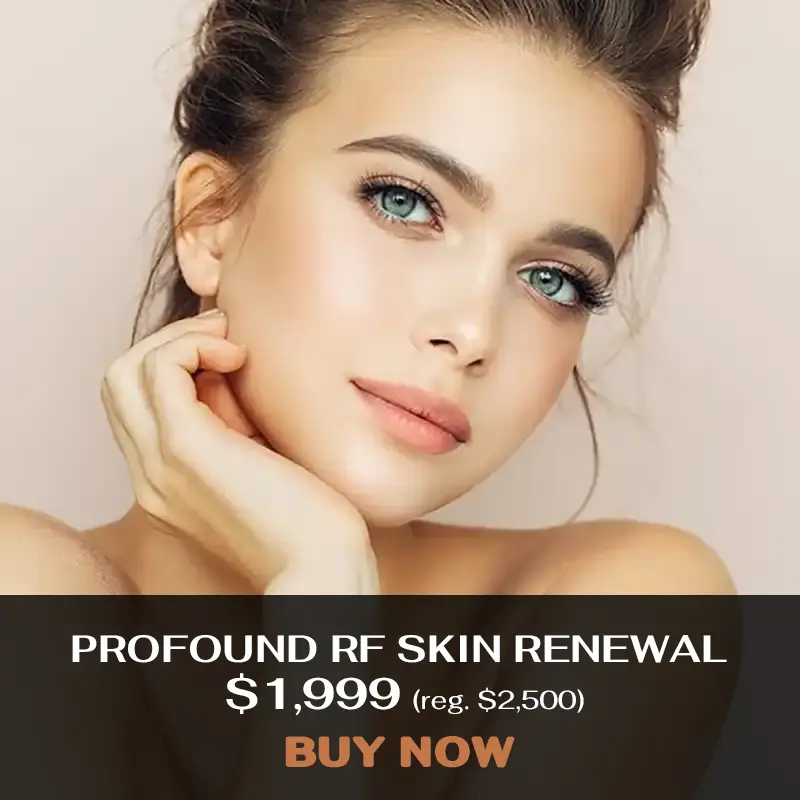 Profound RF Treatment Special Offer