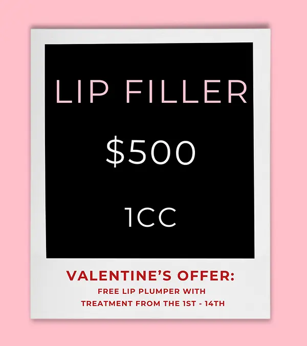 Lip Filler Valentine's Day Medical Spa Special